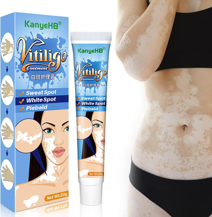 Crema KanyeHB para el tratamiento del vitíligo