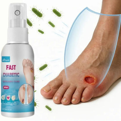 Spray Ximonth para sanar heridas de diabéticos
